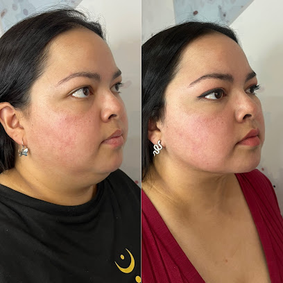 Clinica El Llano Estética Facial